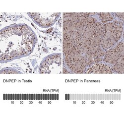 Aspartyl Aminopeptidase Antibody, Novus Biologicals:Antibodies:Primary